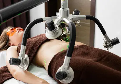 Galvanometer Laser Welder 4 Medical Device Manufacturing